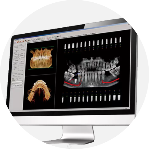 dental x-rays