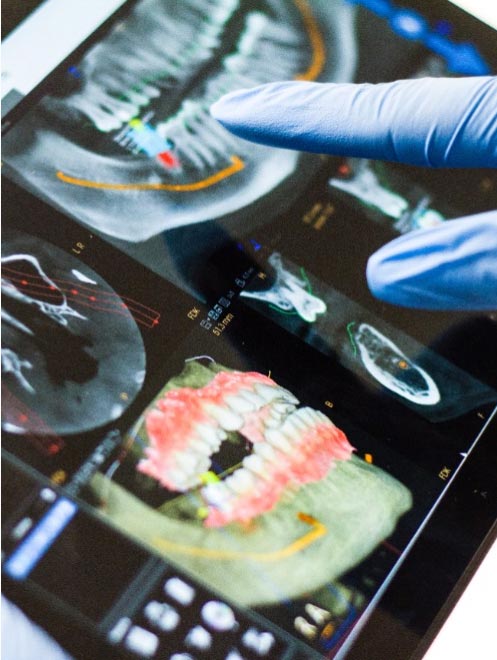 dentist pointing at results of 3d x-rays