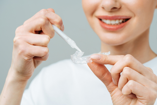 at-home whitening kits