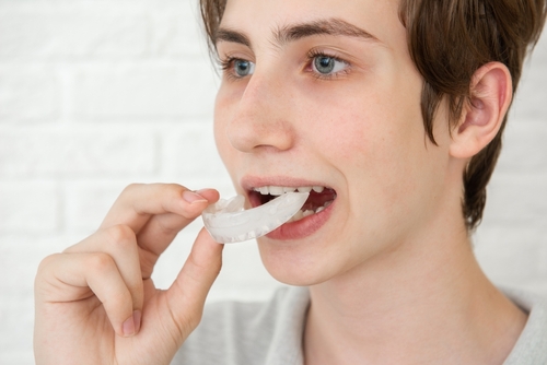 young man putting in a mouth guard